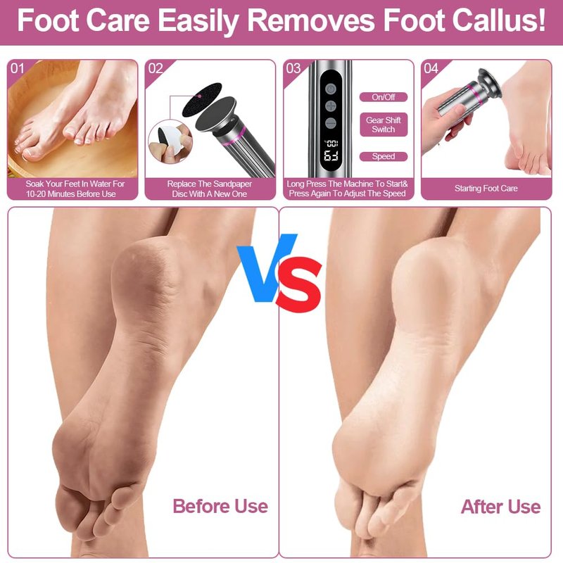 Electric Foot Callus Remover with LED Speed Display - 2 in 1 Foot File (Sandpaper Discs & Grinding Heads), 9 Adjustable Speeds, Cordless Use, Valentine's Day Gift for at-Home Pedicure