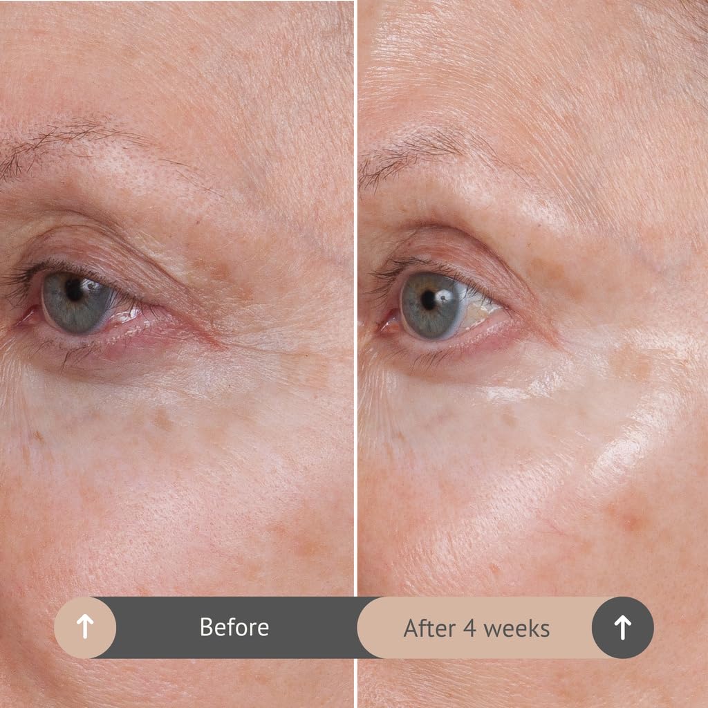 Consult Beaute VOLUMAGEN COLLAGEN EYE CREAM with Hyaluronic Acid, Hydrating, Skin Plumping - Targets Deep Under Eye Hollows, Visibly Smoothen Lines & Wrinkles 0.5 oz