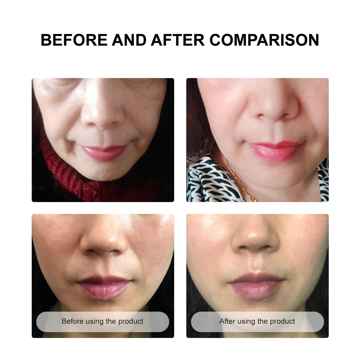 SECRET STRIPS Anti Wrinkle Patches to Remove Face Wrinkles Treatment,Smooth Nasolabial Folds Wrinkle Patches Face Masks Beauty Product