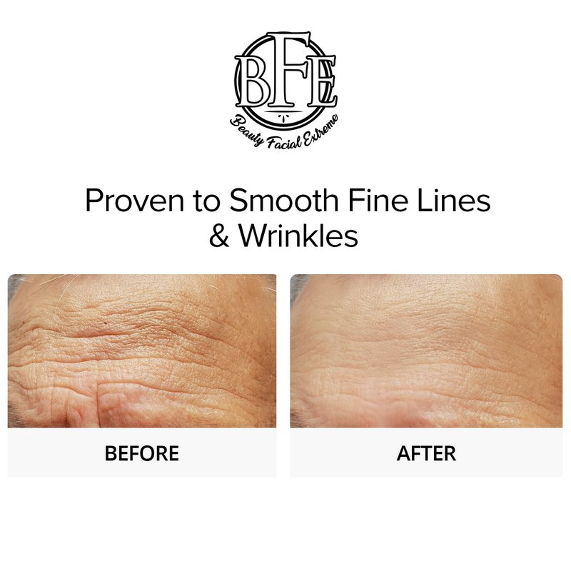 Glycolic Acid 15% Anti-Aging Wrinkle Cream Reduces the Appearance of Fine Lines, Wrinkles, Age Spots, Dark Spots & Improves Dull Looking Complexion. Includes A.H.A & Green Tea Moisturizer.