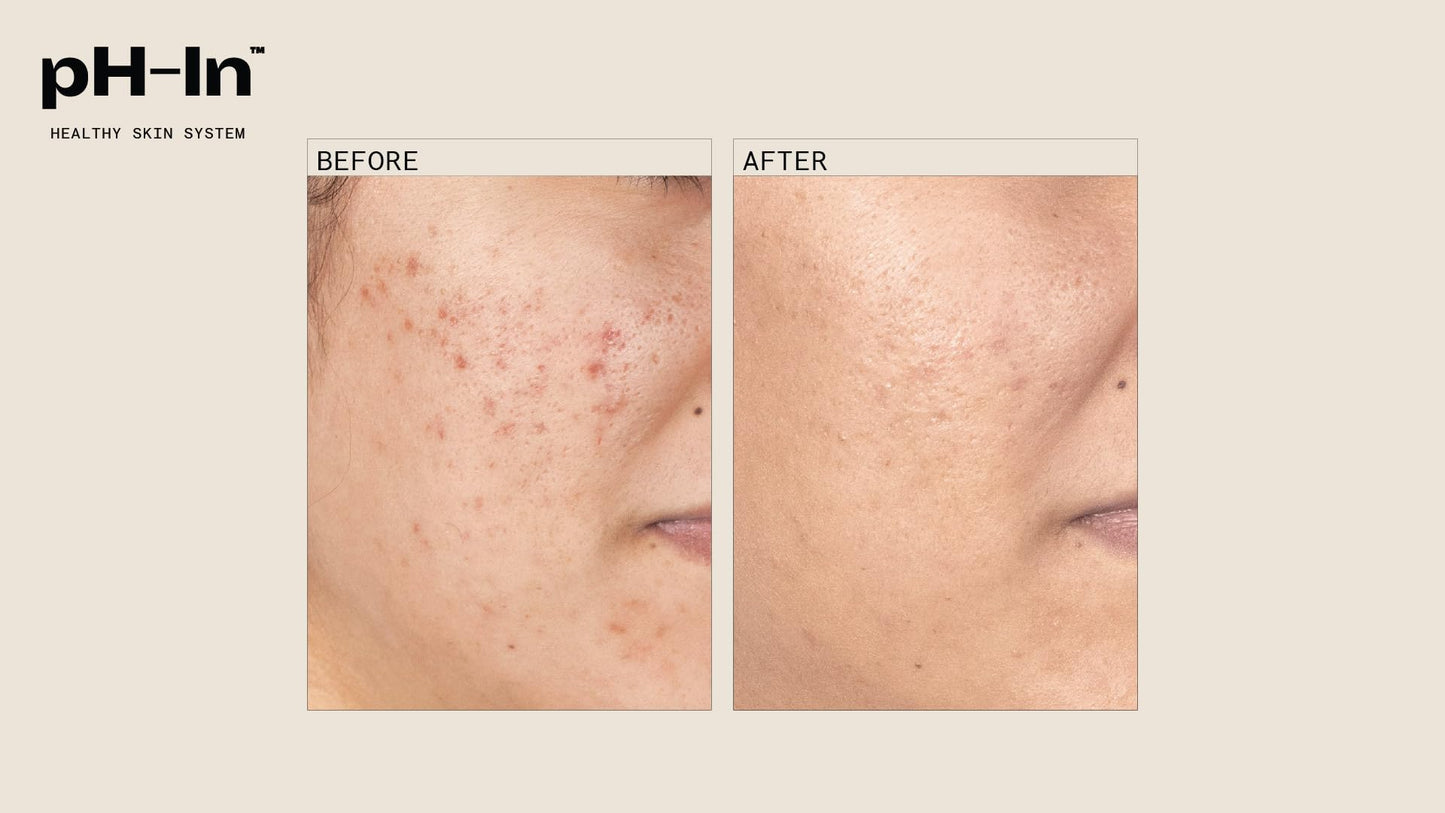 pH-In 3 Step Healthy Skin System