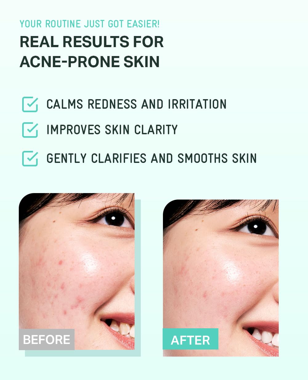 BRING GREEN Tea Tree CICA Soothing Toner | Mild Daily Skincare Routine for Cooling and Hydrating Effect (8.5 Fl. Oz., 250ml)