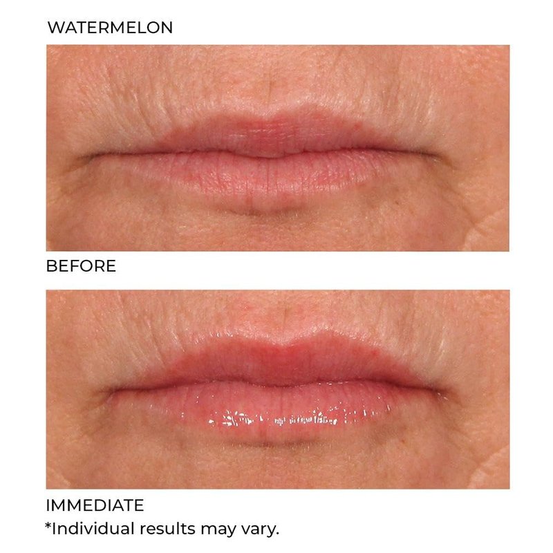 Hydro-Screen Lip Treatment - Hydrating & Nourishing Formula for Soft Lips