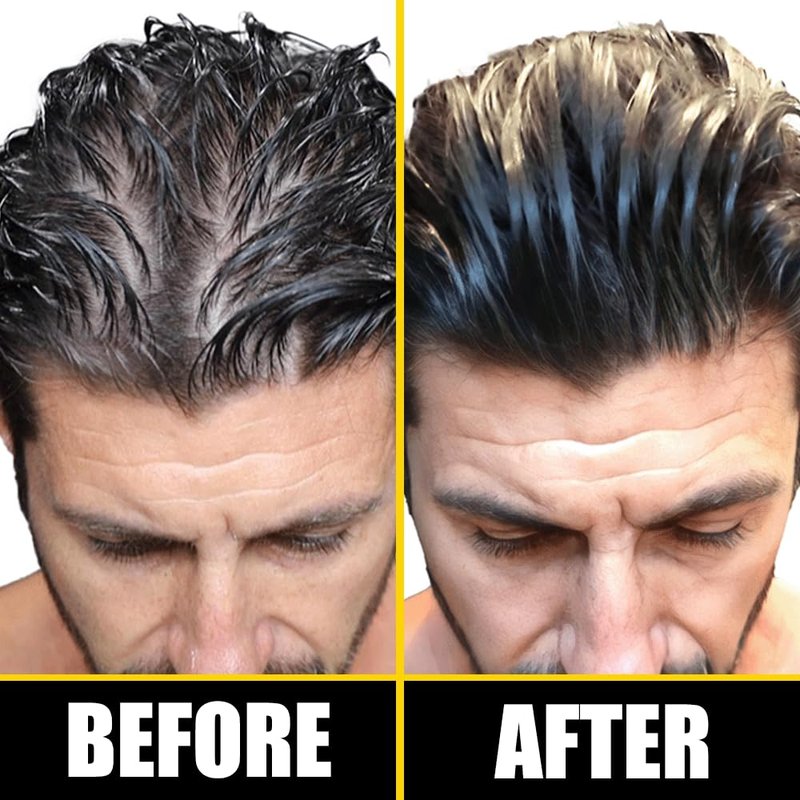 Pete & Pedro BOOST Hair & Beard Strengthening & Growth Natural Scalp Health Serum Oil For Men & Women - With Rosemary, Biotin & 20 plus Essential Oils | Shark Tank Featured, 2 oz.