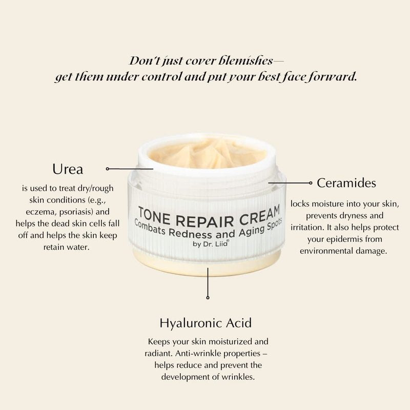 EPILYNX Tone Repair Moisturizer For Dark Spots on Face - Gluten Free, Vegan for Sensitive Skin by Dr. Liia