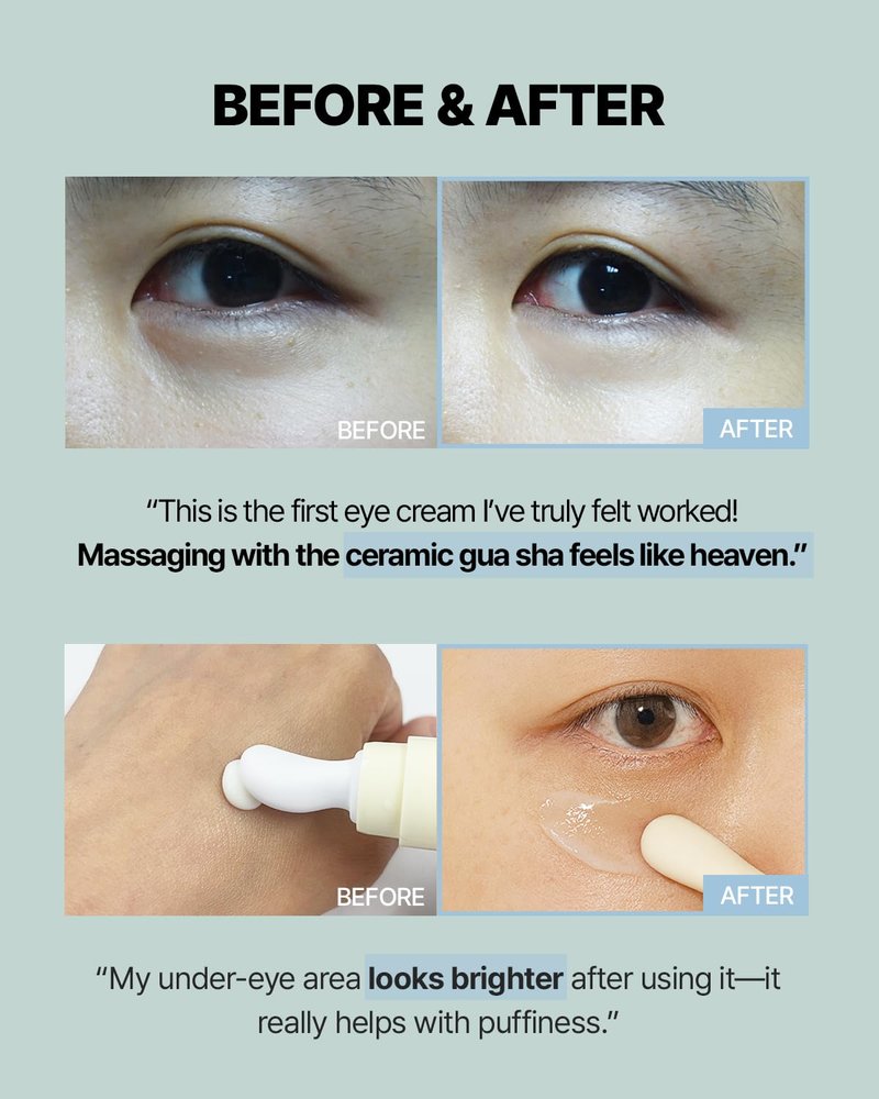 Ectoin Gua Sha Eye Cream - Korean Anti-Wrinkle Treatment for Dark Circles & Puffiness | 30ml