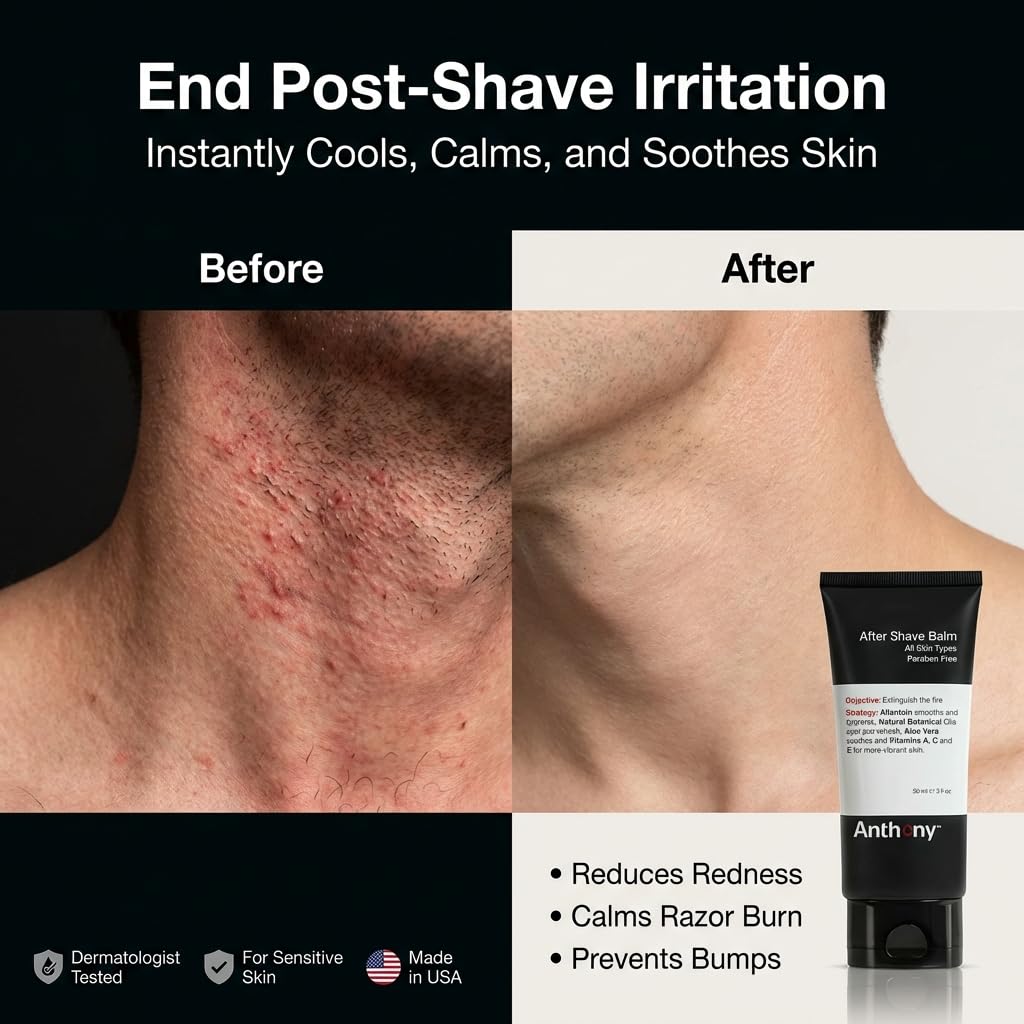 Anthony After Shave Balm for Men, Cooling & Hydrating Lotion with Vitamins A, C & E, Aloe Vera & Botanical Extracts, 3 fl oz, Aftershave Soothes, Moisturizes & Nourishes Skin, Reduces Razor Burn