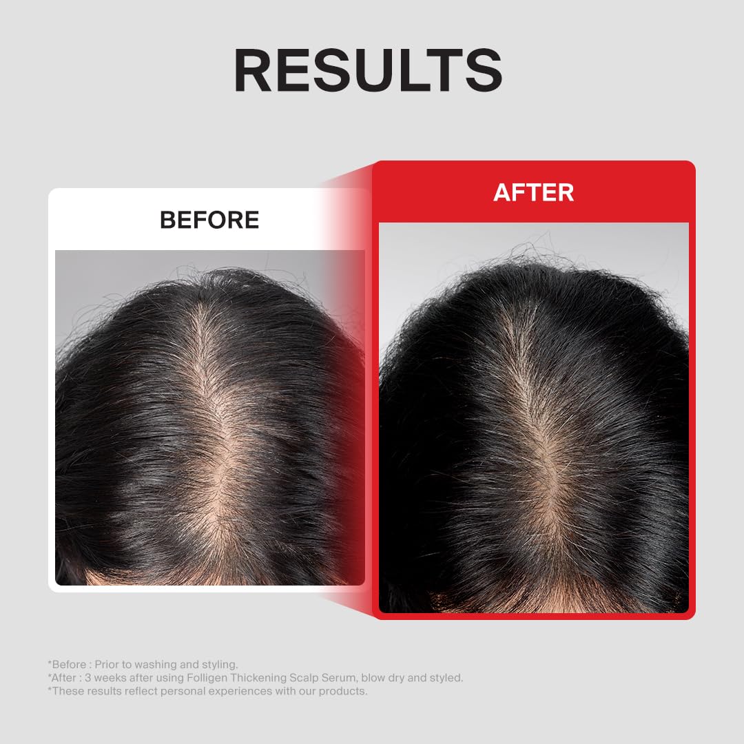 Dr.FORHAIR Folligen Thickening Scalp Serum 1.7 oz | Biotin Density Serum for Thicker, Fuller-Looking Hair | Peptide Scalp Treatment | Korean Haircare