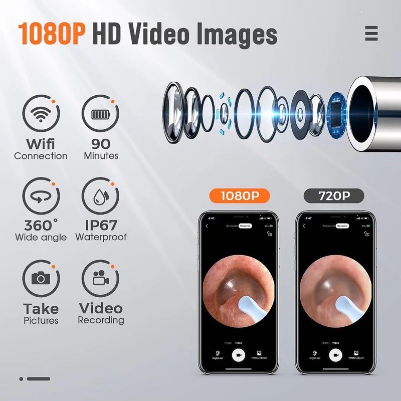 Ear Wax Removal Tool Camera - Ear Cleaner with 1080P HD Camera, Otoscope with Light, Earwax Removal Kit for iPhone, iPad, Android Phones (Orange)