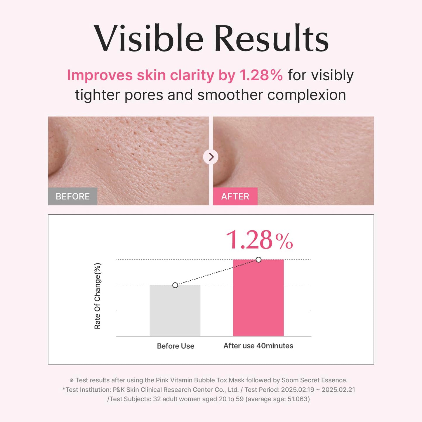 SU:M Micro-Active Pink Vitamin Bubbletox Mask Pack (14-Count) - Foaming Bubble Mask & Deep Pore Cleanser for Hydration with Fermented Pink Vitamin 12 - Korean Skin Care