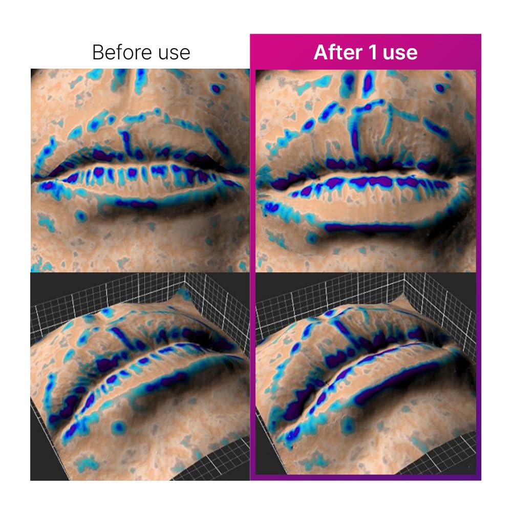 Elishacoy | THE VOLUME Lip Plumper Mild | Natural Volumizing Lip Gloss | Soft Glossy Finish | Vegan Lip Care | 0.14 oz (4 g)