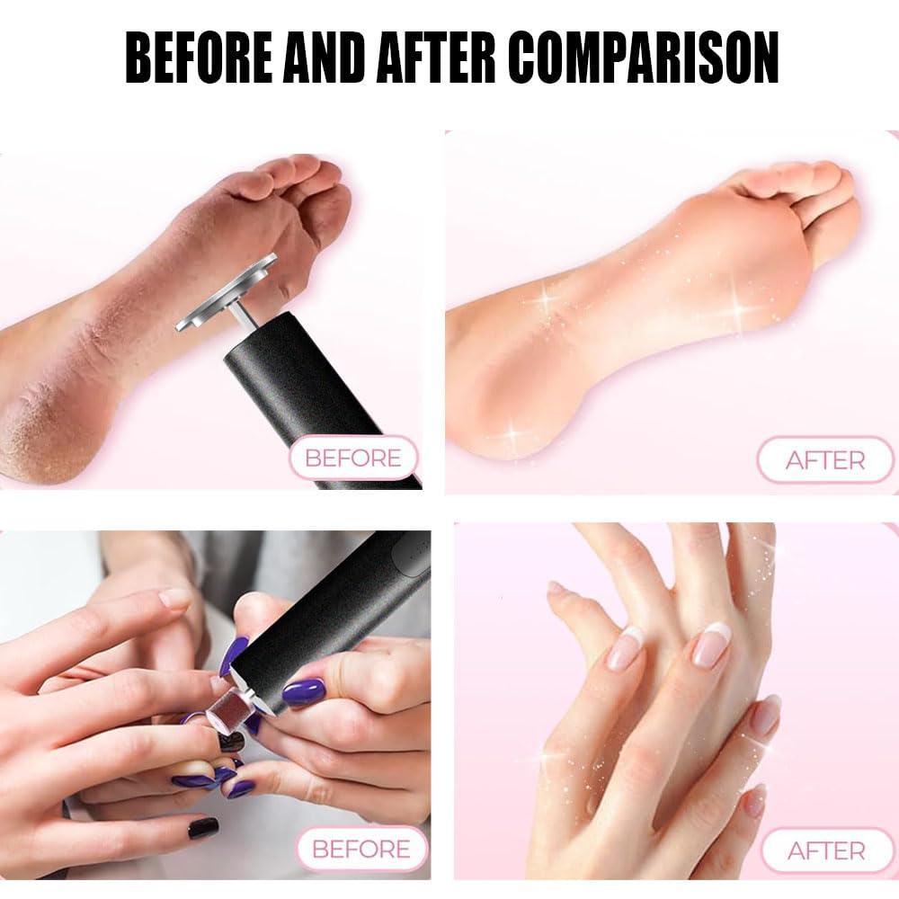 Cordless Electric Callus Remover - 2 in 1 Rechargeable Foot File with Nail Sander | 6 Adjustable Speeds for Smooth Feet