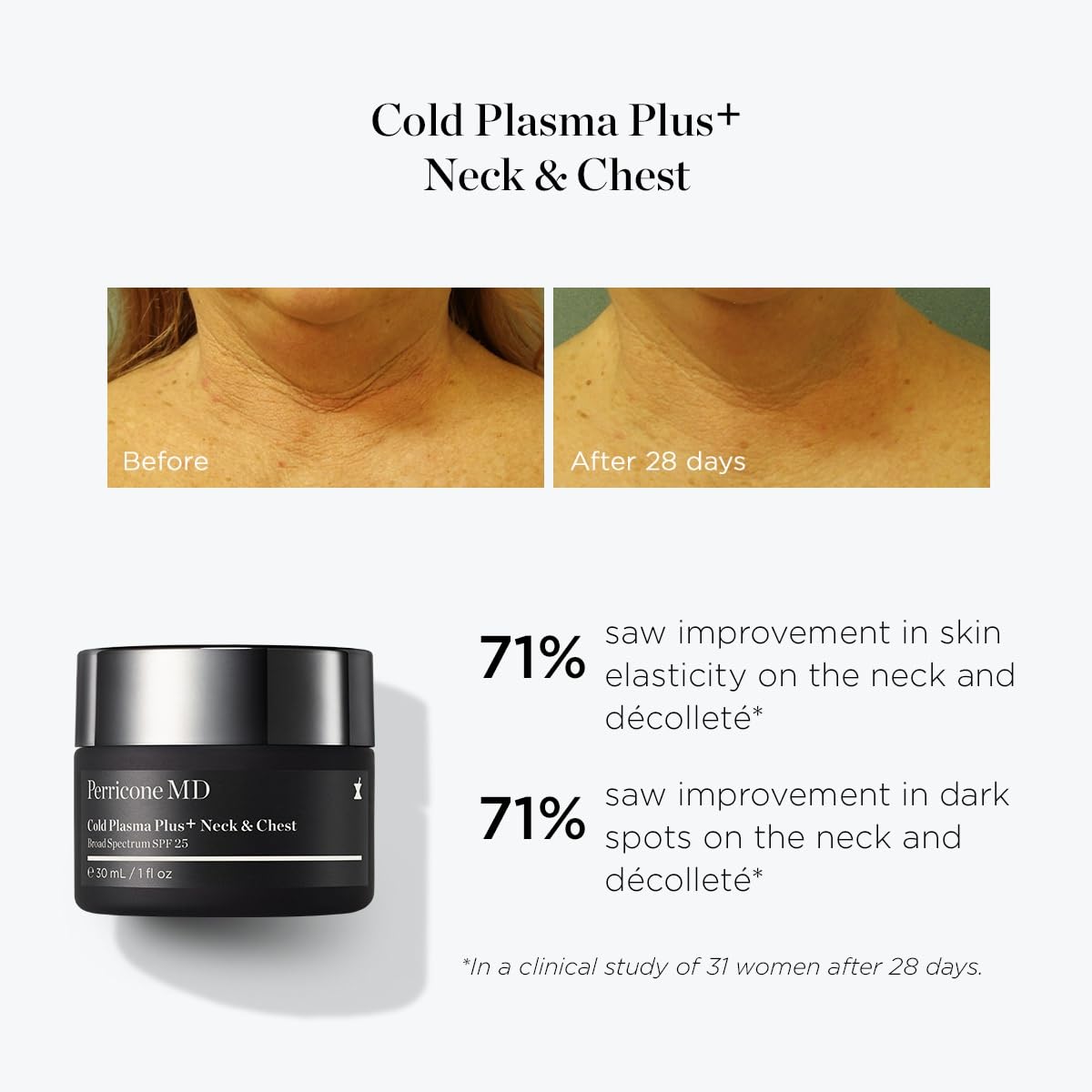 Perricone MD Cold Plasma Plus+ Neck and Chest Broad Spectrum SPF 25 – Neck Firming Cream for Tightening and Firming Sagging Skin – Wrinkle Cream for Crepey Skin & Decollete, 1 fl oz