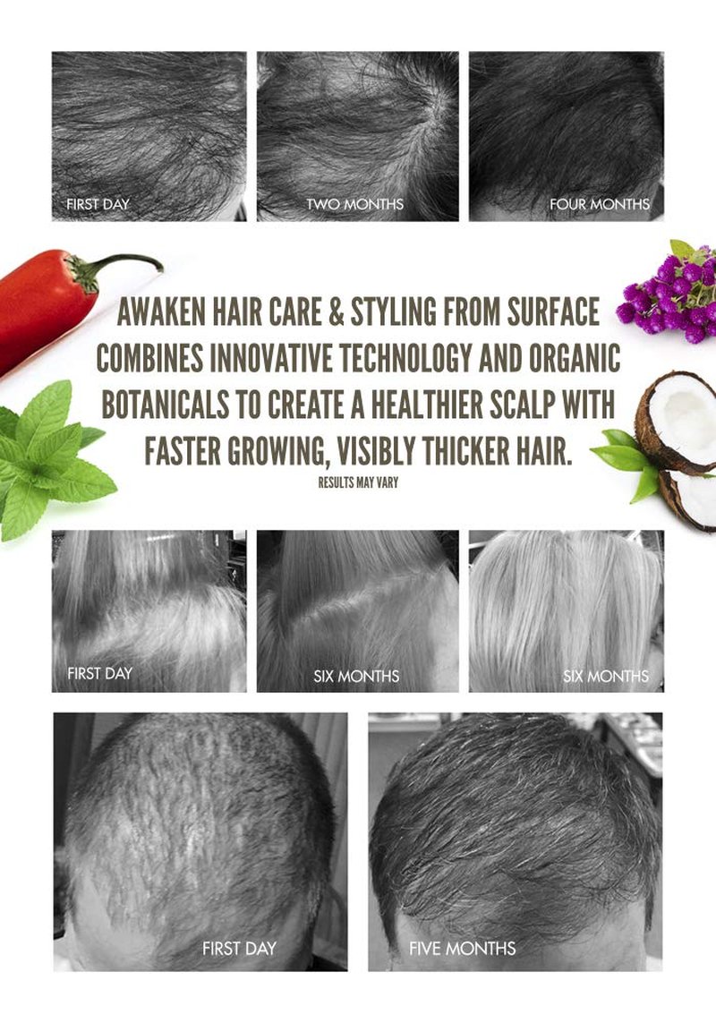 Awaken Therapeutic Conditioner - Natural Ingredients for Thinning Hair & Healthy Scalp | 12 oz