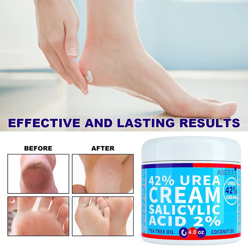 Urea Cream 42% - Premium Foot Cream with Salicylic Acid & Tea Tree Oil - 4 oz for Soft, Smooth Skin