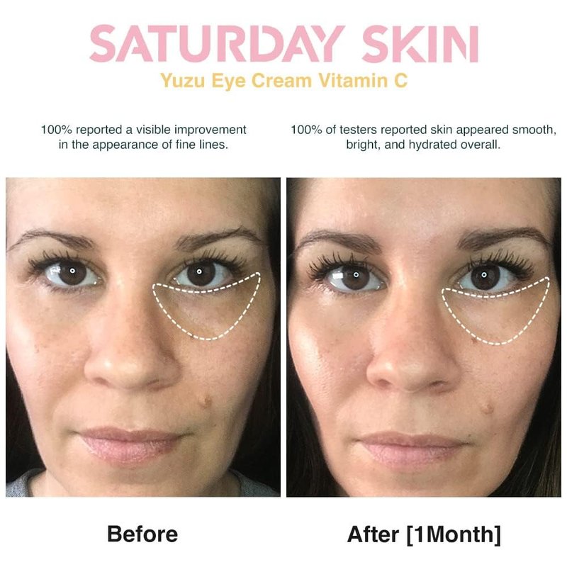 Yuzu Eye Balm - Vitamin C & Niacinamide Under Eye Cream | Hydrating Anti-Aging Treatment for Dark Circles (15ml)