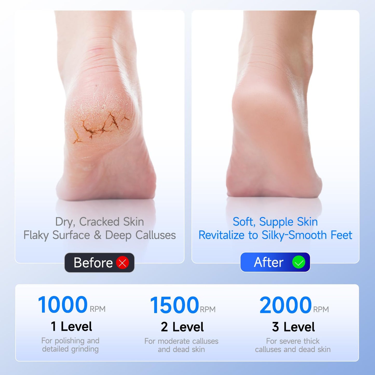 Upgraded IPX6 Waterproof Electric Foot Callus Remover - Rechargeable Pedicure Tool with Stainless Steel Heads, Portable Foot File for Cracked Dry Heels/Dead Skin + Storage Bag (Black)