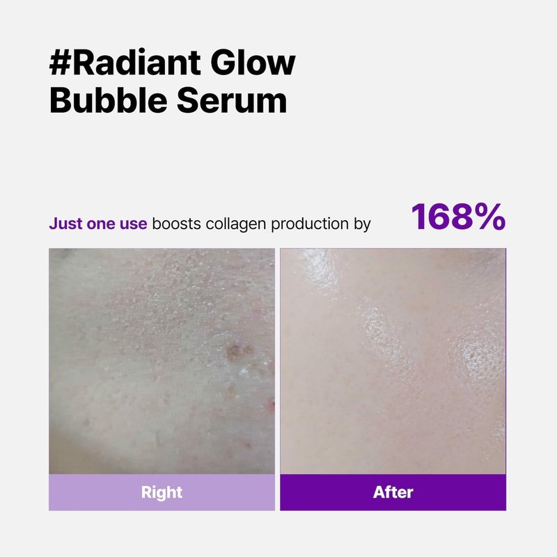 Pharmeus SKINEGO Super Glow Deep Collagen Bubble Serum with 1,005,189ppb Collagen – Anti-Aging, Hydrating, Skin-Firming, Fine Line Care, Korean Skincare – 2.36 fl.oz