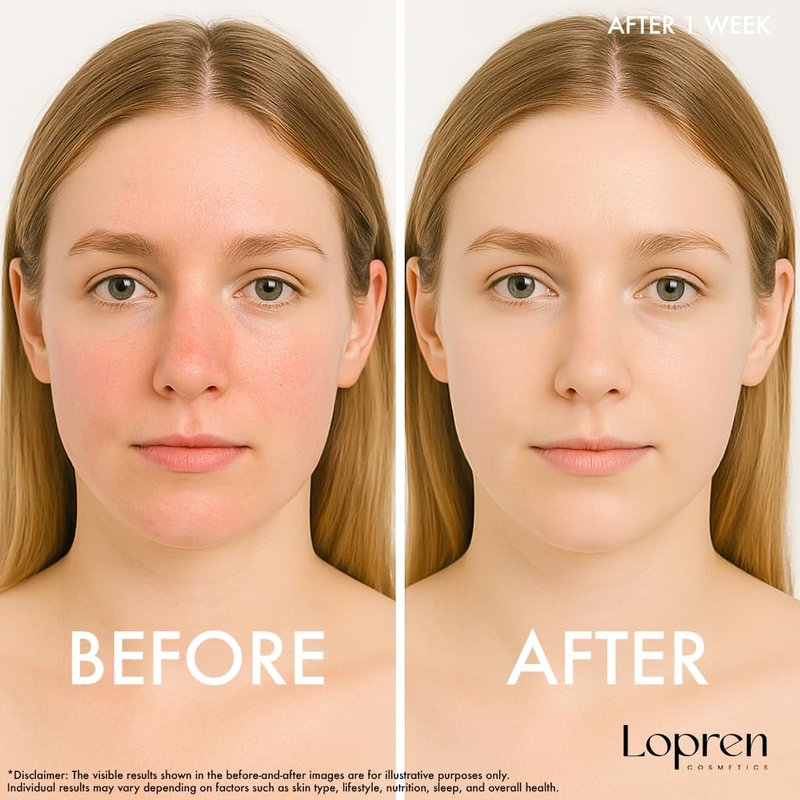 Lopren Facial Cleansing Gel for Sensitive Skin, Chamomile & Aloe-Based Hydrating Face Wash, Gentle Non-Irritating Cleanser with Plant Proteins, Fragrance-Free, 13.5 Fl Oz