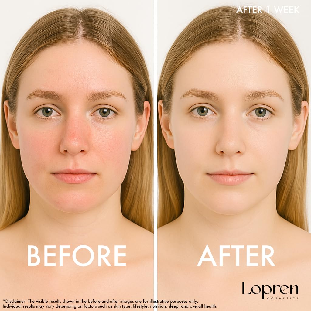 Lopren Facial Cleansing Gel for Sensitive Skin, Chamomile & Aloe-Based Hydrating Face Wash, Gentle Non-Irritating Cleanser with Plant Proteins, Fragrance-Free, 13.5 Fl Oz
