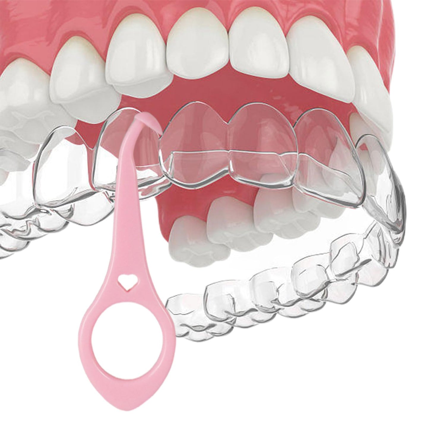 Clear aligner removal tool-invisible removable braces, invisible aligner remover-aligner remover-fixer remover (40pcs)