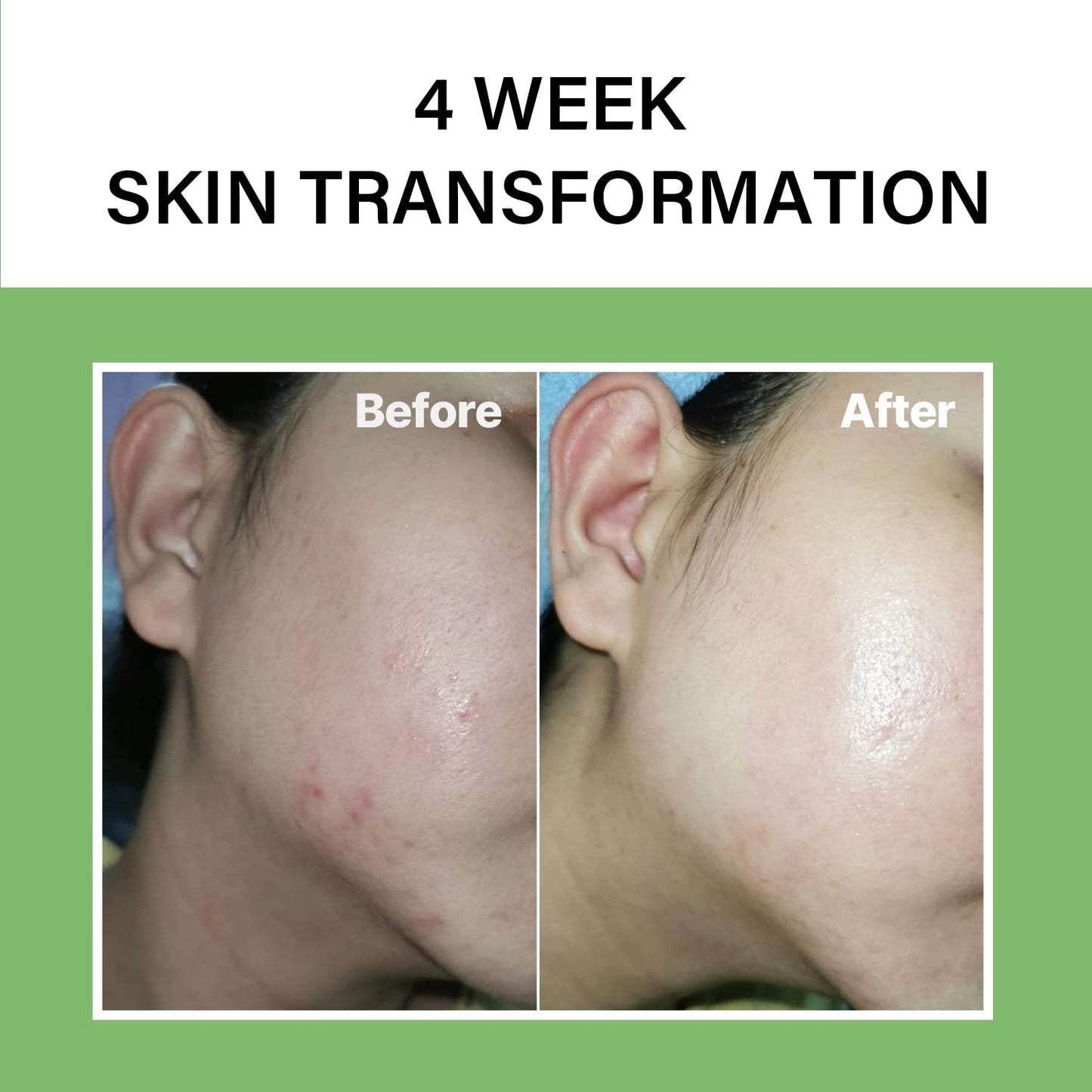 celimax Ji.Woo.Gae Heartleaf BHA Peeling Pad(60 pads) + Noni Energy Ampoule 30ml Bundle