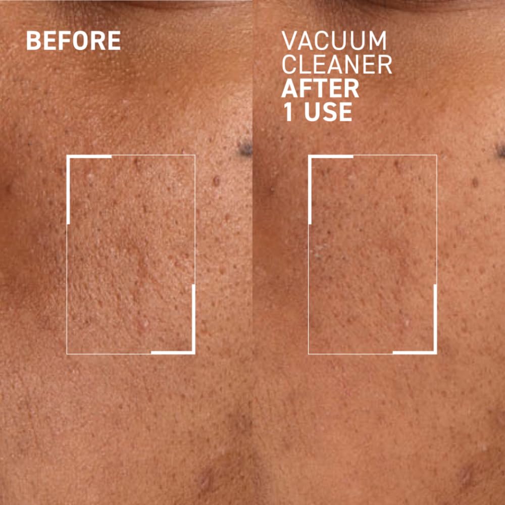 Dr. Brandt Pores No More Vacuum Cleaner - Pore-Purifying Mask to Unclog & Shrink Pores - 1 oz
