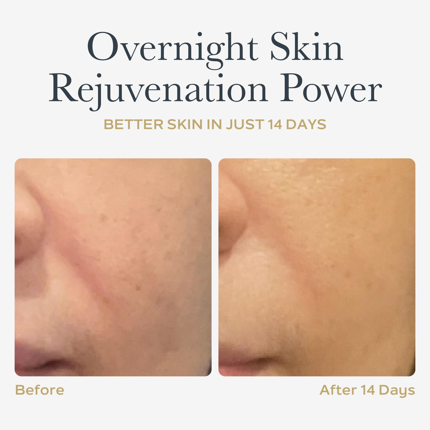 SOTHYS Renovative Micro-Capsules, Vitamin C Serum for Face
