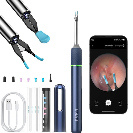 KWYBOW Note5 Ear Wax Tweezers with Camera, 10MP Ear Cleaner Camera Otoscope with Light,Real-time Remote Video with Ear Pick & Tweezers,12 Pcs Ear Scoops for Whole Family