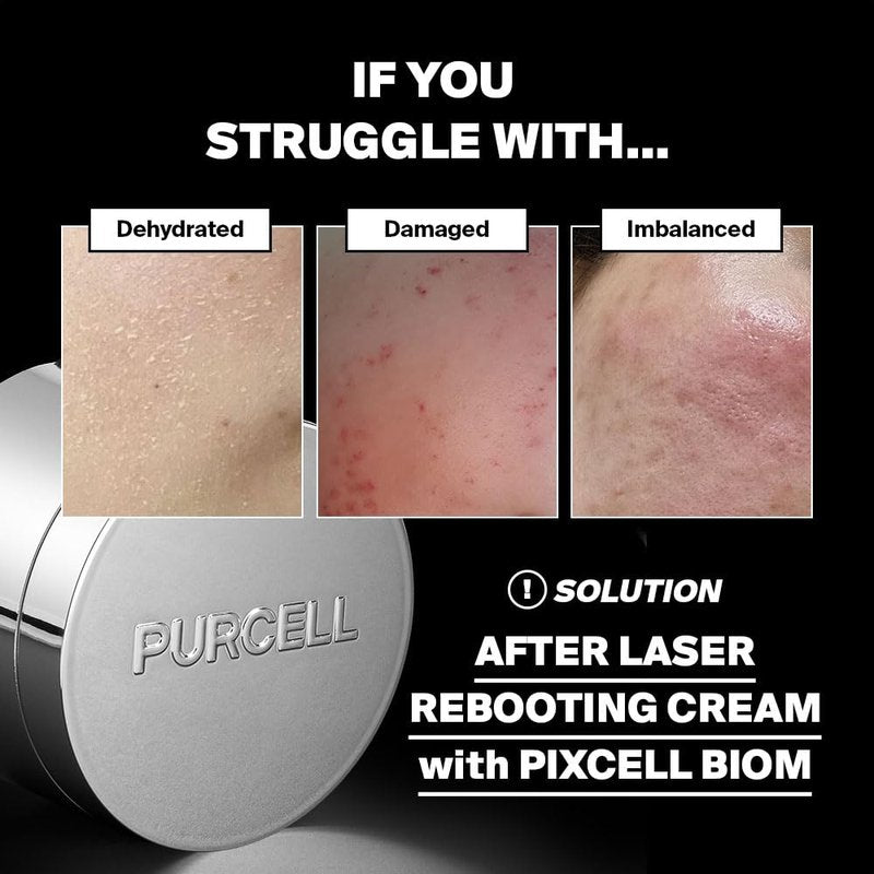 PURCELL PIXCELL BIOM™ After Laser Rebooting Cream for Probiotic Barrier Recovery with Niacinamide, Panthenol, Suitable for Sensitive Skin, 1.69 fl oz(50ml)