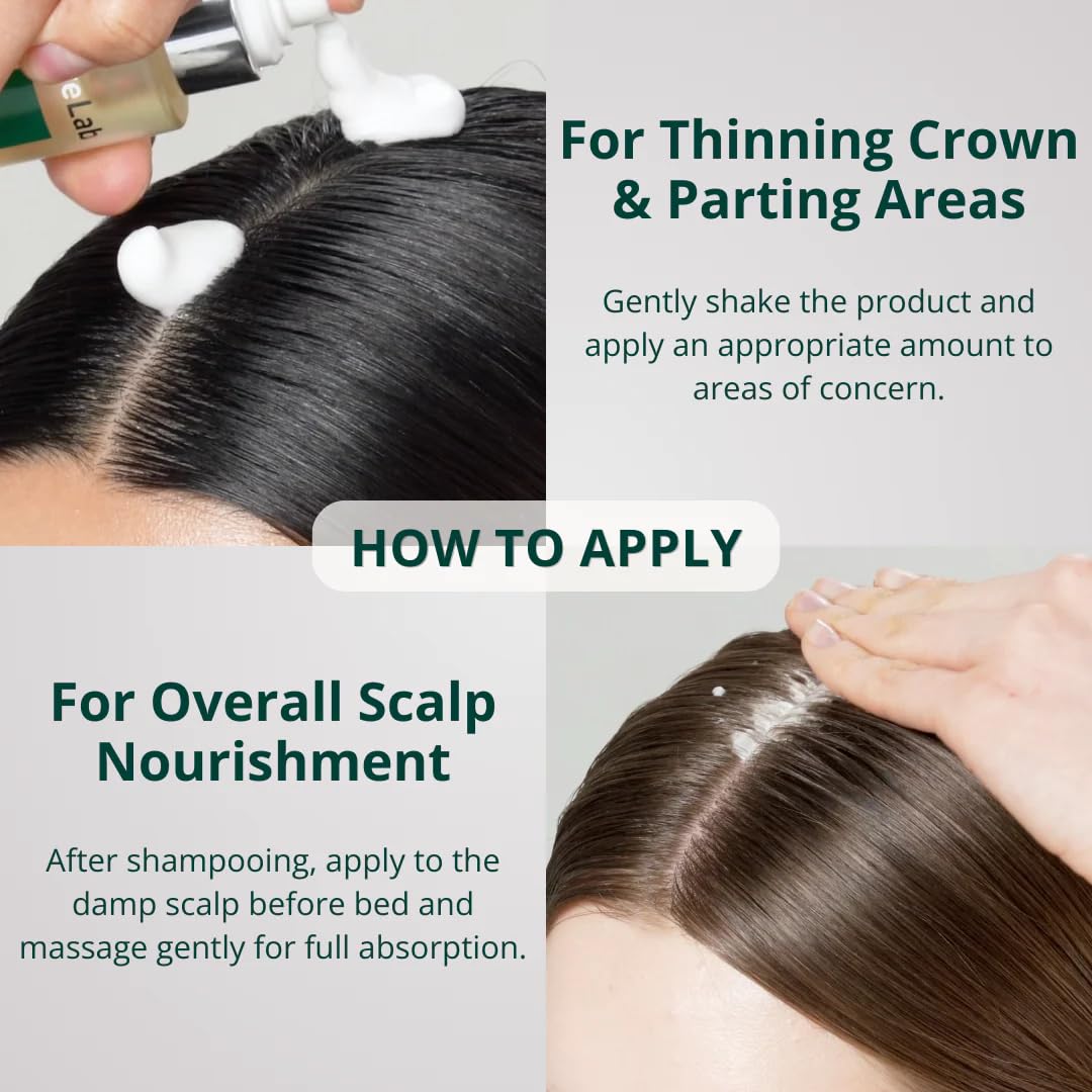 ViveLab Hair Growth Serum - Micro Foam Scalp Treatment with Biotin, Rosemary Oil & Caffeine | Vegan, Clinically Tested for Thicker Hair