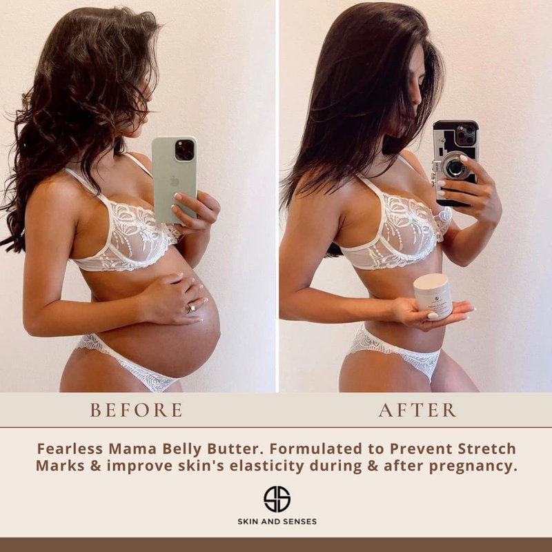 Fearless Mama Pregnancy Body Butter - Deep Hydration Belly Butter for Stretch Marks | 5 oz with Shea & Cocoa Butter