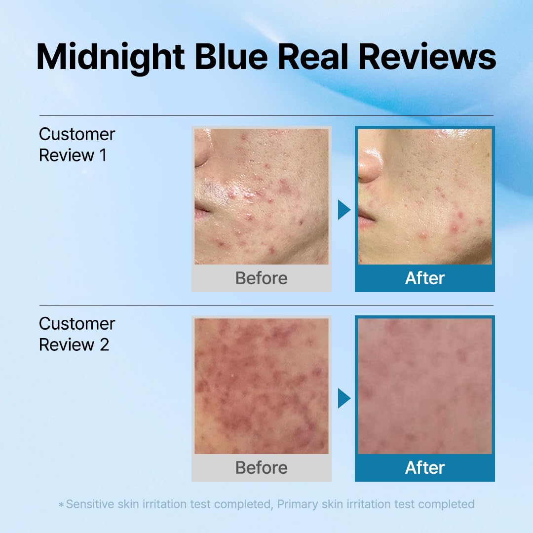 DearKlairs Blue Comforting Duo | Calming&Rich Moist Soothing Creams for Deep Moisture, Korean Skin Care for Dry, Sensitive Skin