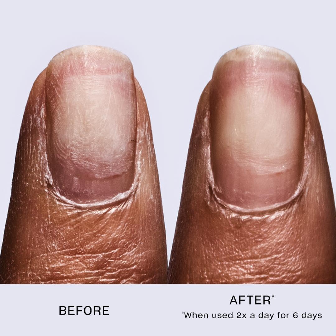 OPI Nail Serum - Bond Building Keratin Treatment for Stronger Nails | Nail Growth Formula