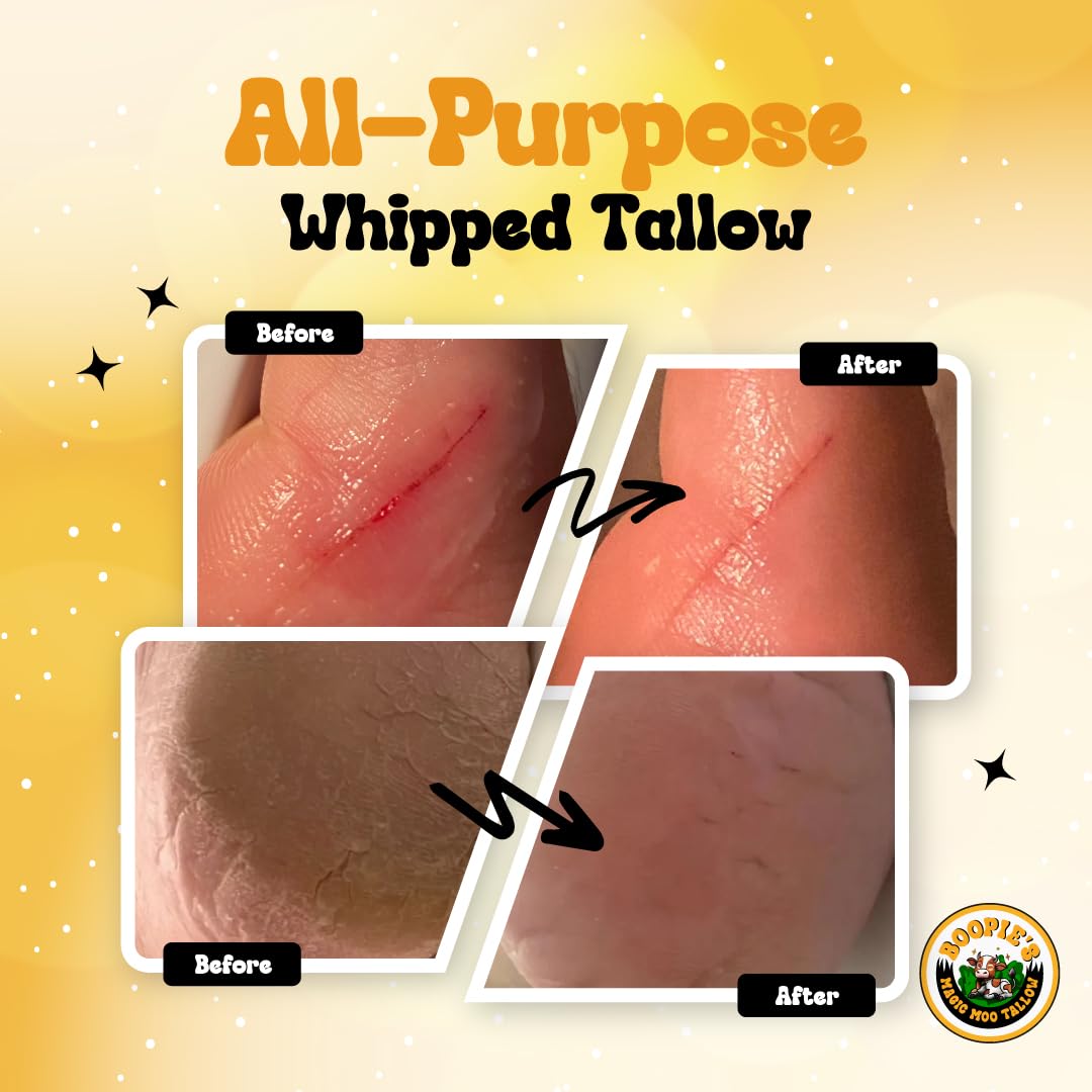Magic Moo All Purpose Whipped Beef Tallow Skincare for Acne, Eczema, Dry Skin, Moisturizer, Stretch Marks & Hydration. Suet Tallow for Face with Organic Emu Oil. Contains All Organic Ingredients, 4oz