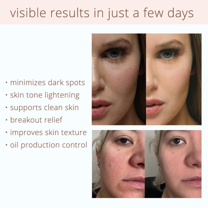 Coffeeface Anti-Aging Moisture Pads with Exfoliation and Hydration | 3-in-1 Textured Skin Treatment | Hypoallergenic for All Skin Types | 8 Count |