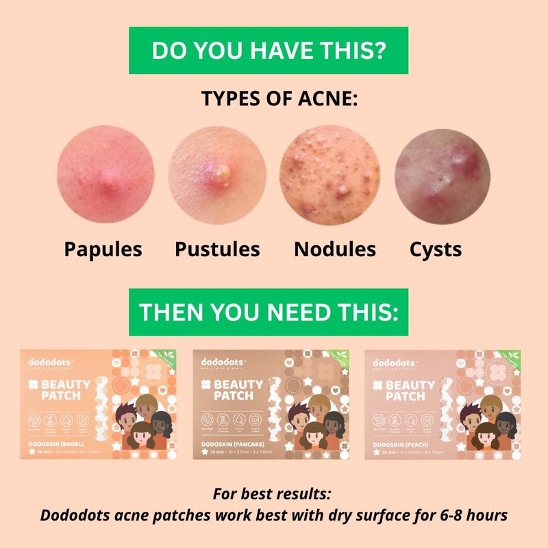 Dododots Pimple Patches for face - Cute Acne Hydrocolloid Patch, Pimple Patches for Zit, Spot and Blemish Treatment, Bundles (Stars (3 Shades))