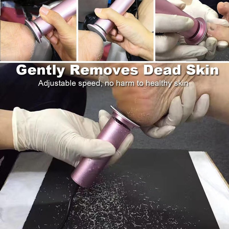 Electric Callus Remover - Adjustable Speed Foot Scrubber with 60 Sanding Discs | Pink Pedicure Tool for Dead Skin Removal