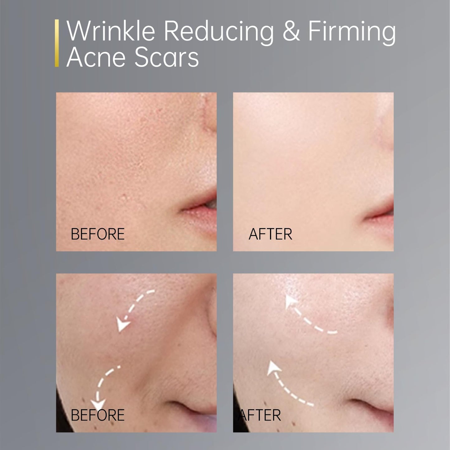 LACUES 60 Day Type I & III Collagen Face Serums,Anti-Aging Wrinkle,Daily Line Smoothing Skin Care Treatment for Fine Lines, Post-Acne Scars | 3% Squalane + jojoba oil, 60 Individual Capsules
