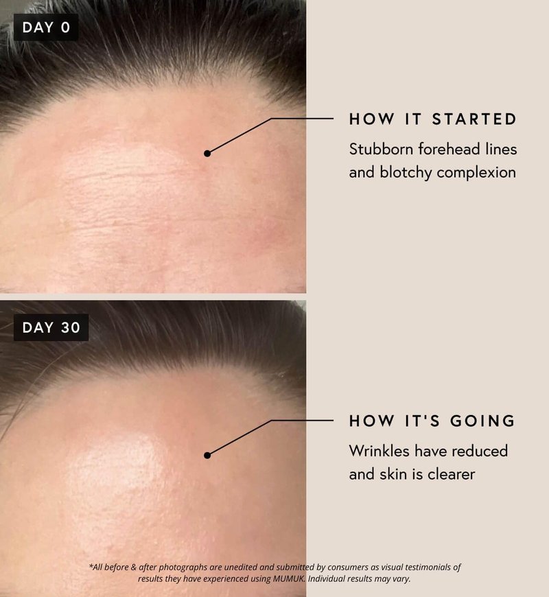 Regenerative Complex EGF Growth Factor Serum - Anti-Aging Cell Renewal & Wrinkle Reduction | 30ml