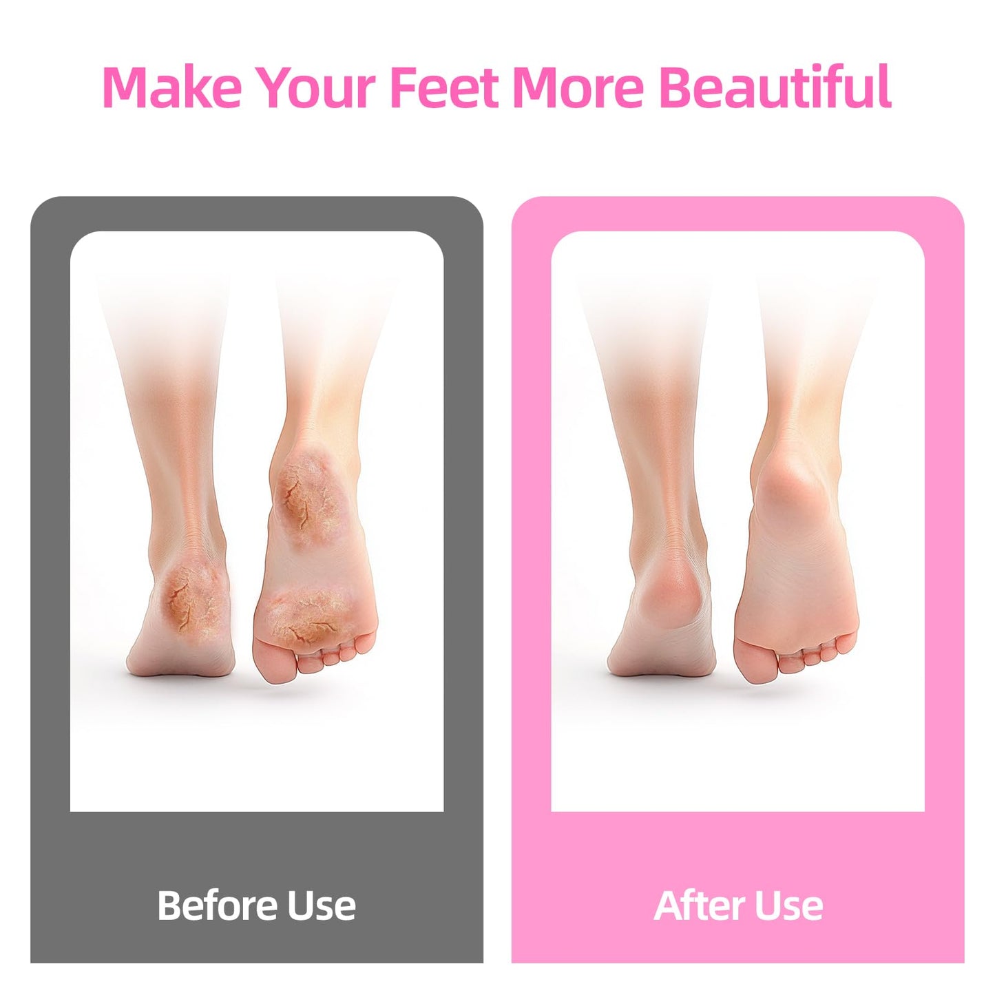 MARSDREAMS Electric Foot Callus Remover, Cordless Rechargeable Adjustable Speed Feet File with Nano Glass Grinding Disc, Wireless Professional Pedicure Tool for Heel Dead Skin and Calluses