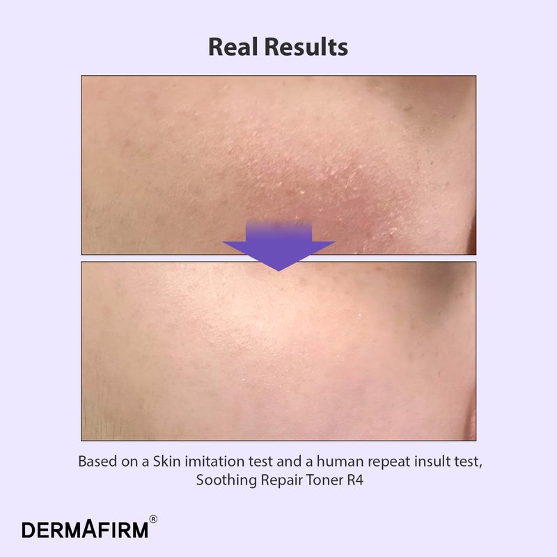 DERMAFIRM Soothing Repair Face Toner R4 | Hydrating Moisturizing & Soothing Toner for Skin Troubles w/Eucalyptus, Peptide & Collagen | Gentle for All Skin Types No Animal Trials No Paraben 6.76 fl oz
