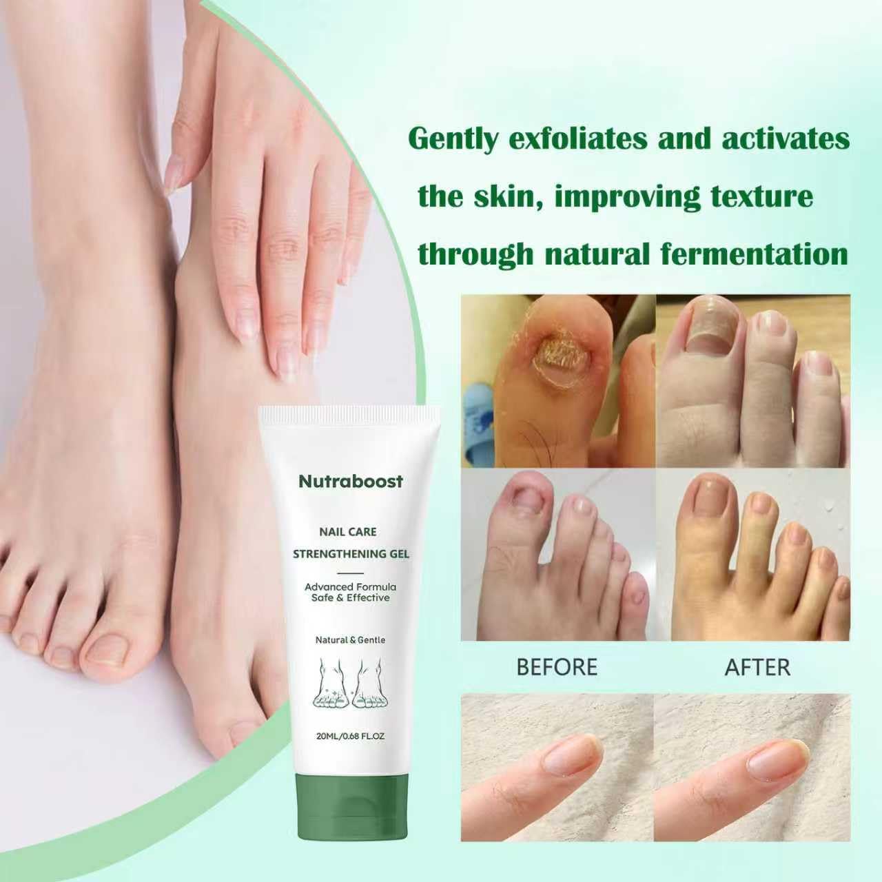 Natural Nail Care Gel, Nutraboost Strengthening Cuticle Serum for Damaged & Brittle Nails, 20ml (1 pcs) (3pcs)