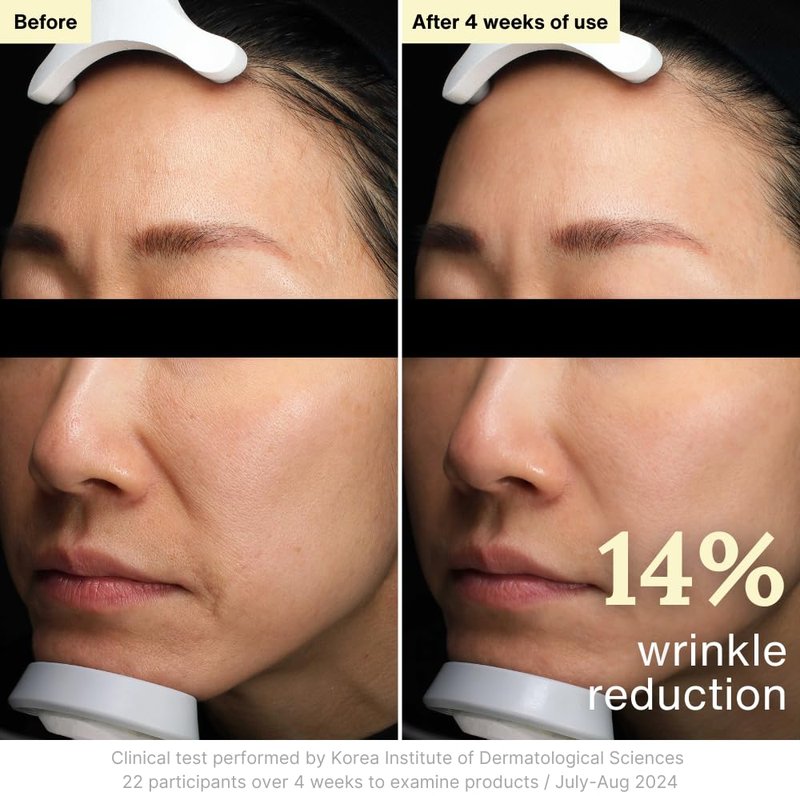 Rothea Resilience Cream - Anti-Aging Face Moisturizer with Bakuchiol & Collagen | 1.7 oz
