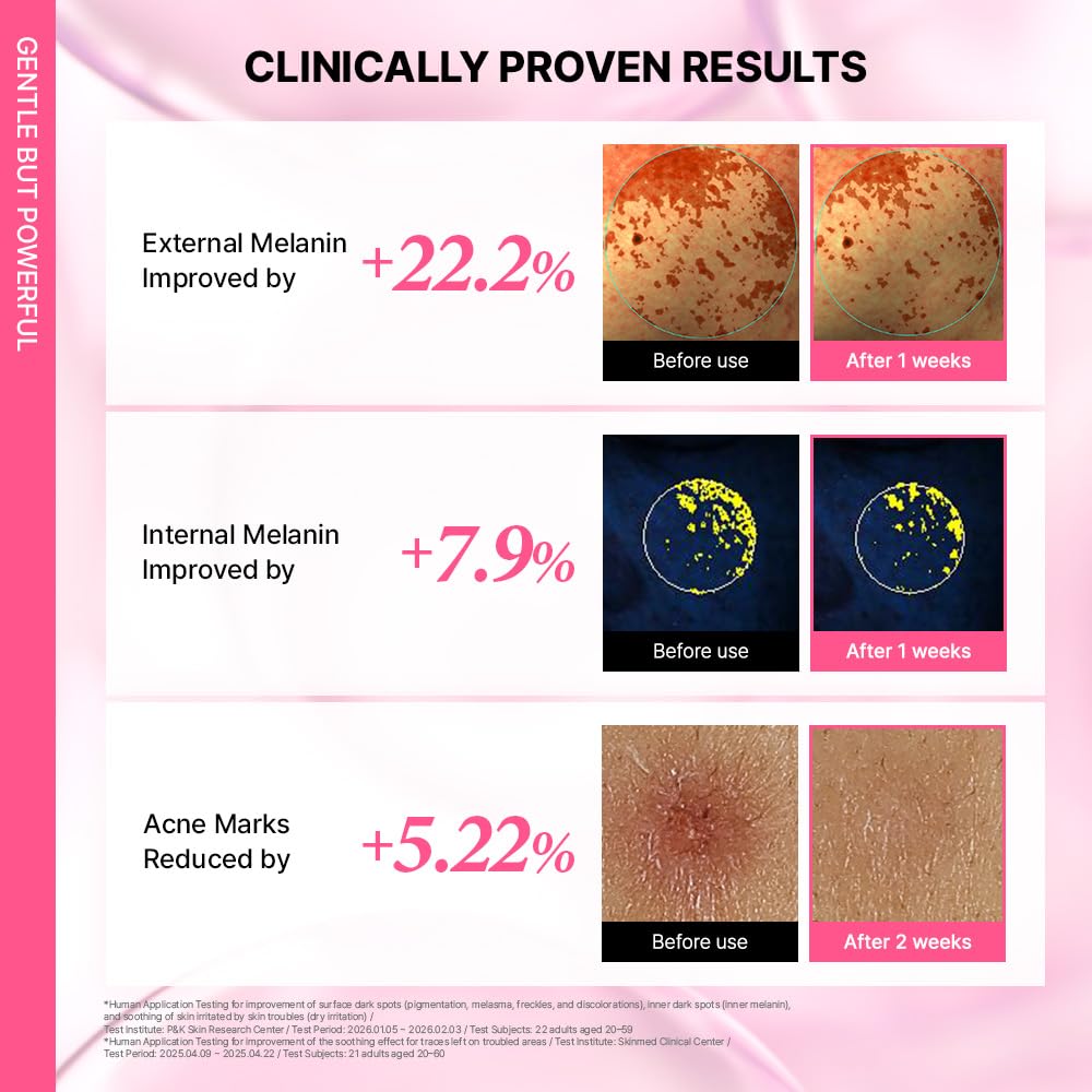 Pink Guava Glutathione Blemish Serum - Uneven Skin Tone Treatment with 99% Pure Glutathione & Niacinamide | 1.01 Fl Oz