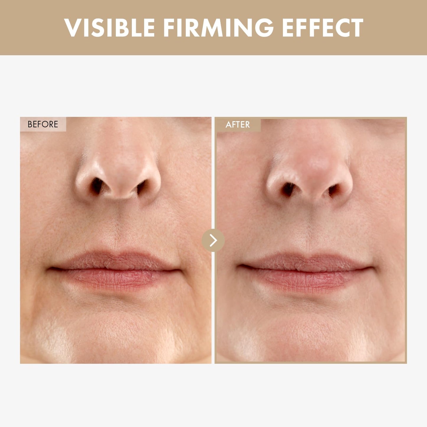 TOSOWOONG Carnosine Lifting Serum for Wrinkle Care & Firming, Fine Lines