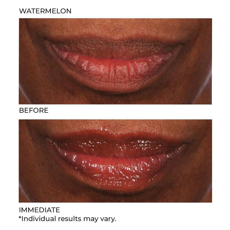 Hydro-Screen Lip Treatment - Hydrating & Nourishing Formula for Soft Lips