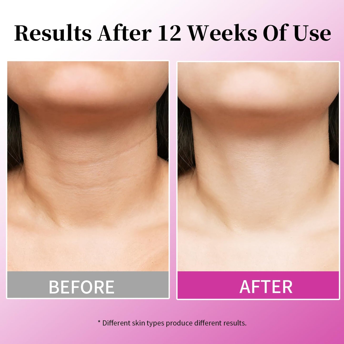 Mr Lilei 4 in 1 Retinol Moisturizer Cream, Tightening & Lifting Neck Cream, Advanced Anti-Aging Face Moisturizer, Reduces Fine Lines & Wrinkles for Neck & Face & Chest (50 ml/1.7 oz)