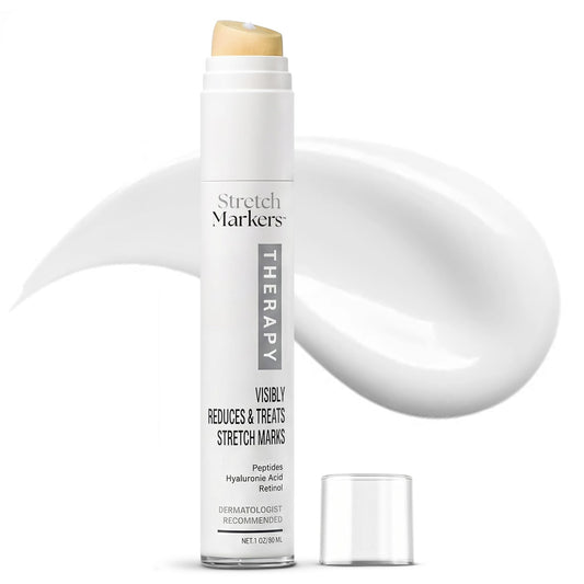 StretchMarkers Therapy Stretch Mark Cream – Visibly Reduces and Treats, Stretch Marks Removal with Retinol, Hyaluronic Acid, Bioactive Peptides & 3D Stem Cell Technology, 1 fl oz