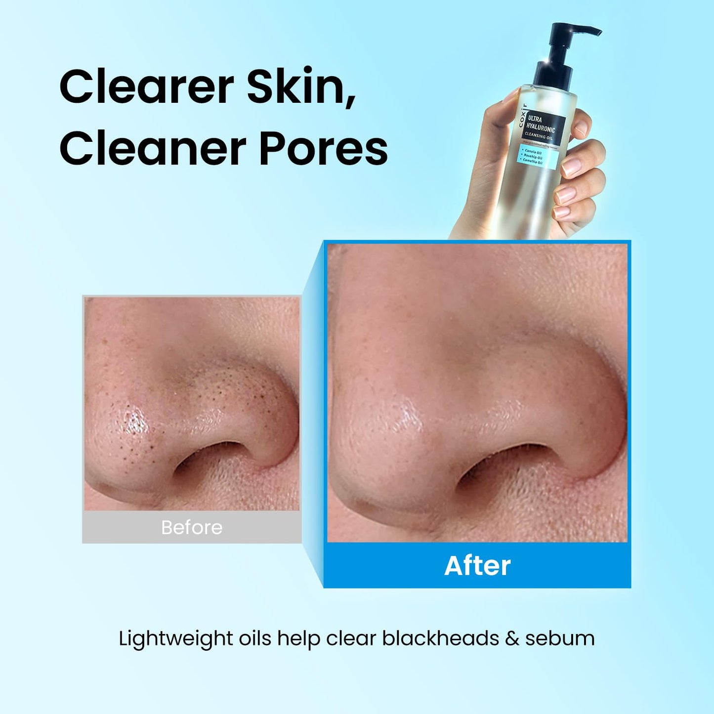 coxir Ultra Hyaluronic Cleansing Oil - Hydrating Korean Oil Cleanser & Makeup Remover for Face, Gentle Fragrance-Free Formula for Dry&Sensitive Skin, Non-Comedogenic [150ml / 5.07 fl.oz]